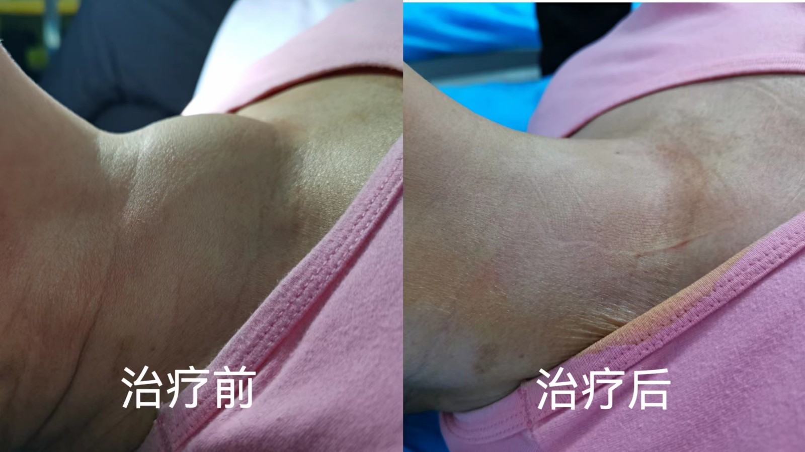 胎兒四維超聲檢查.jpg 胎兒四維超聲檢查.jpg