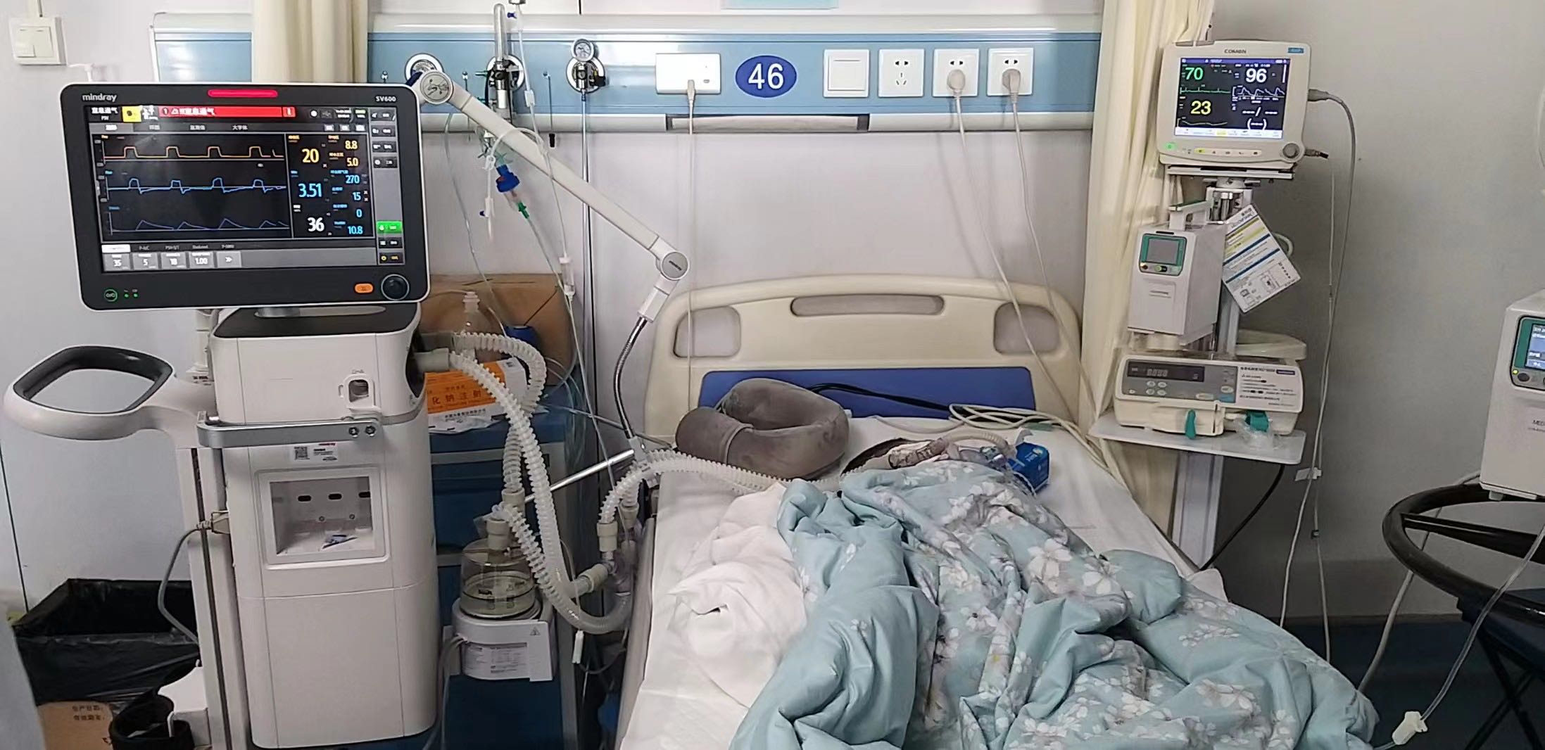 呼吸機.jpg 呼吸機.jpg