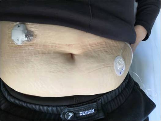 糖尿病3C治療2.jpg 糖尿病3C治療2.jpg