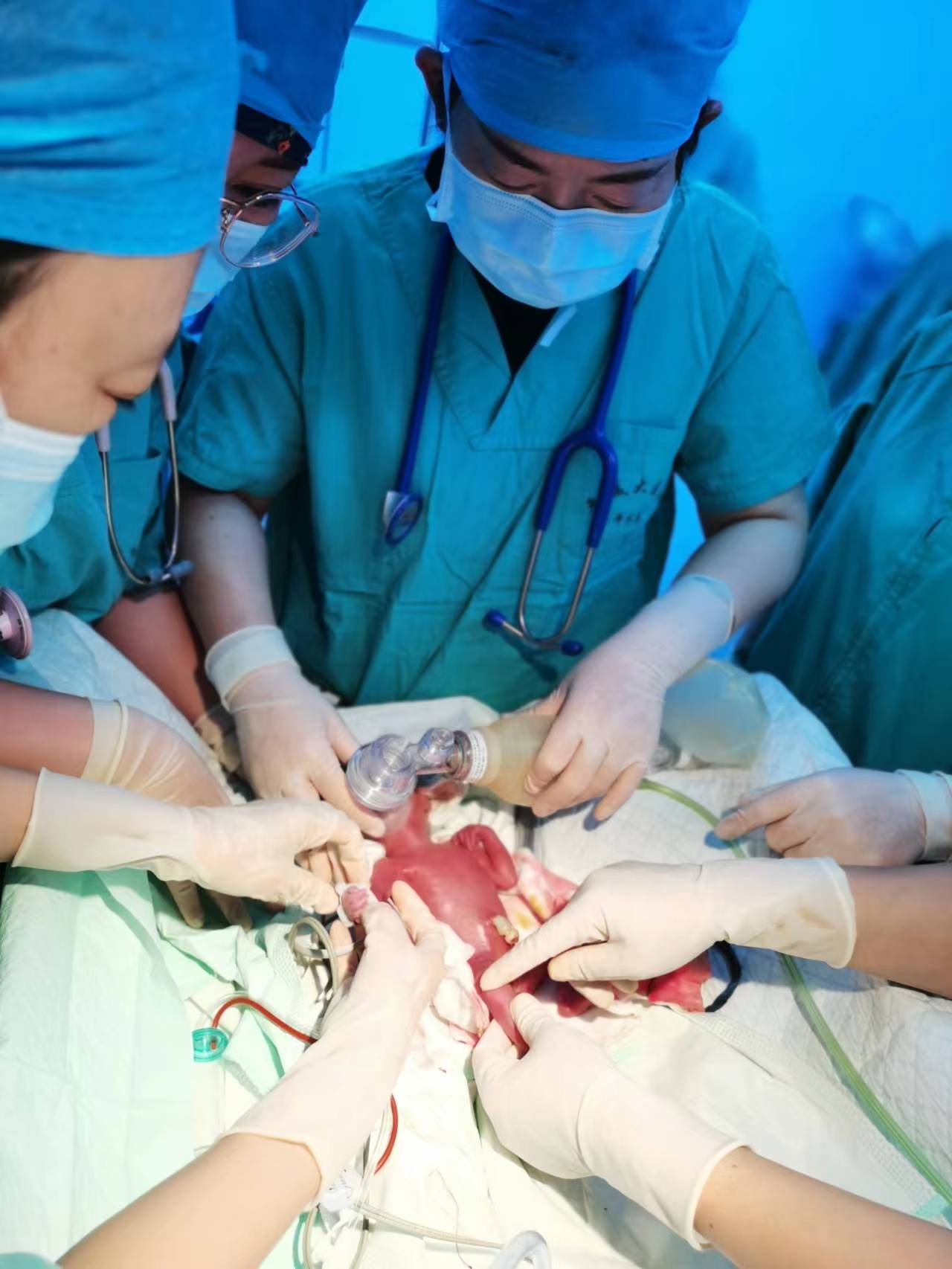 超早產(chǎn)兒2.jpg 超早產(chǎn)兒2.jpg