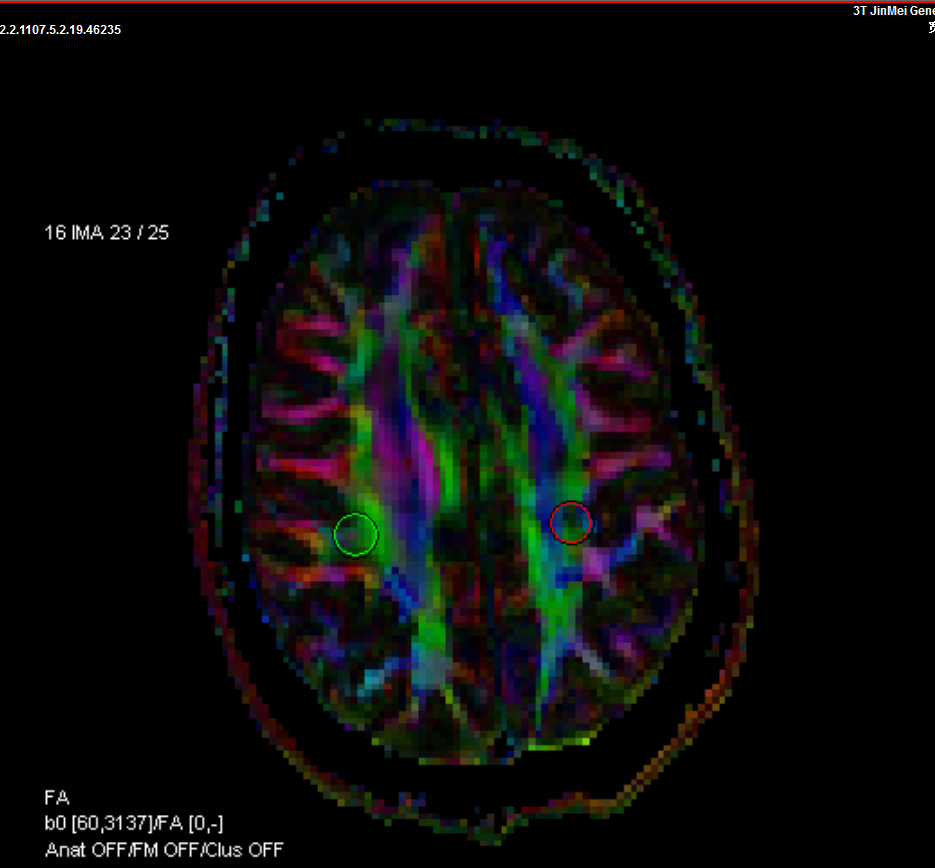 擴(kuò)散張量成像DTI.PNG 擴(kuò)散張量成像DTI.PNG