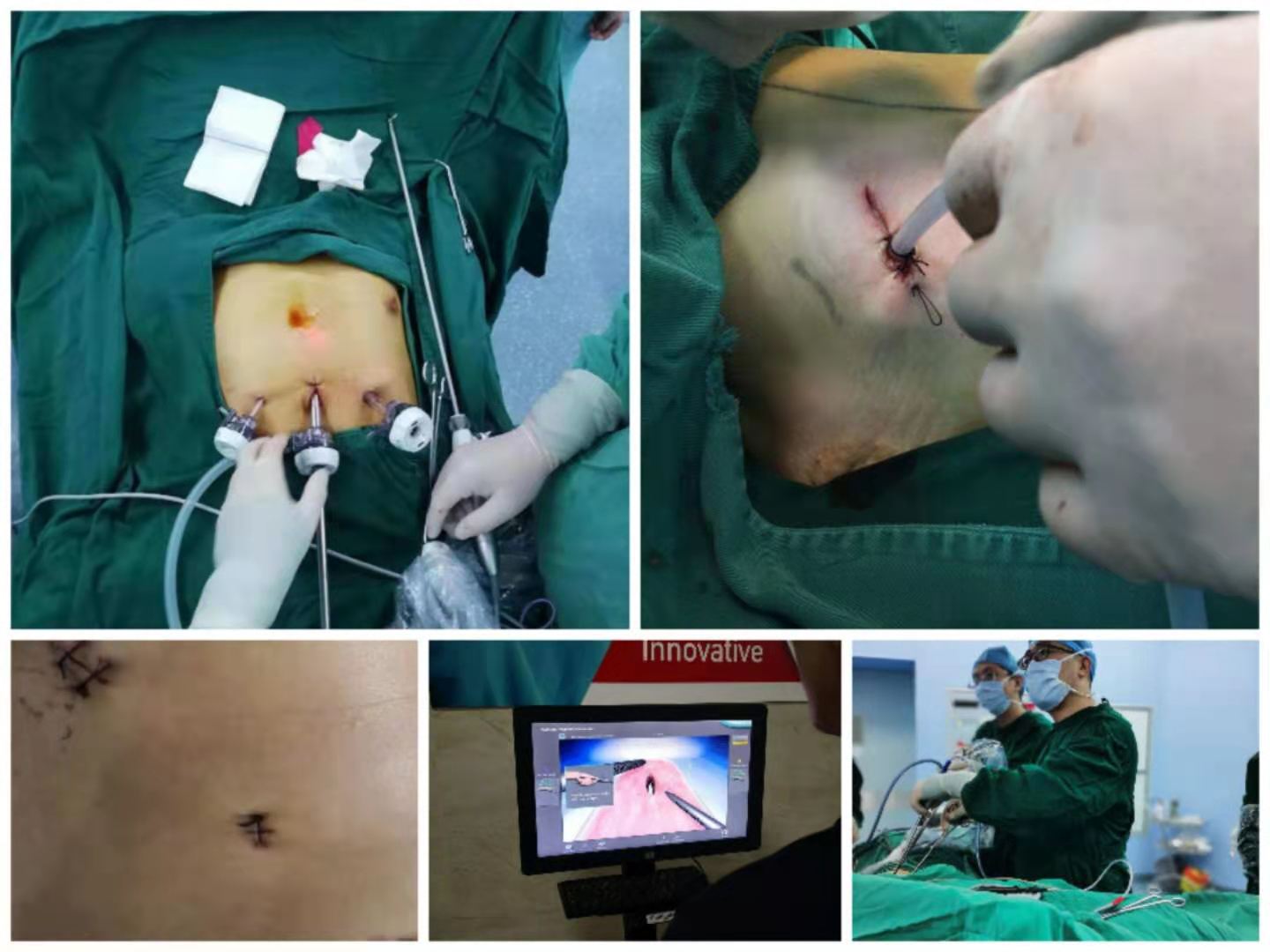 胸外2.jpg 胸外2.jpg