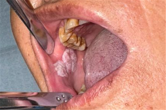 圖片1_副本.png 圖片1_副本.png