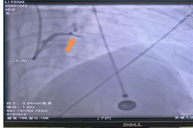 手術前1.jpg 手術前1.jpg