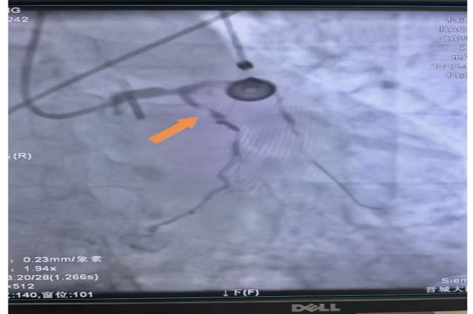 手術前2.jpg 手術前2.jpg