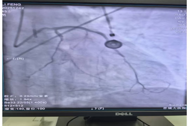 手術后1.jpg 手術后1.jpg