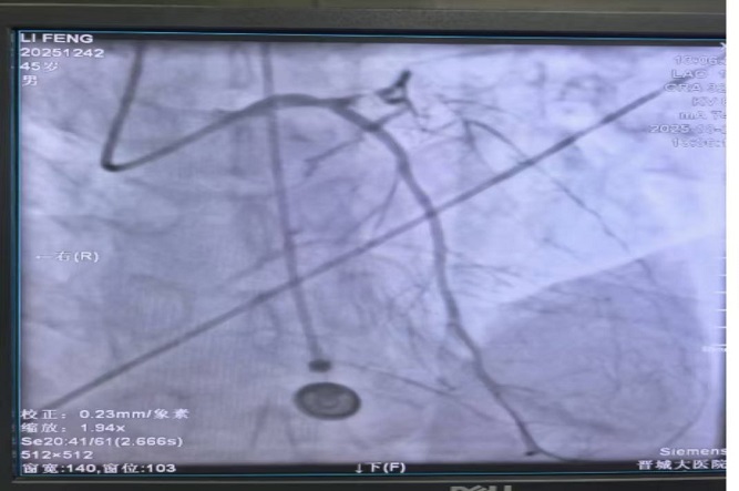 手術后2.jpg 手術后2.jpg